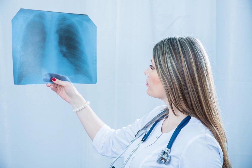 Lập kế hoạch chăm sóc bệnh nhân viêm phổi