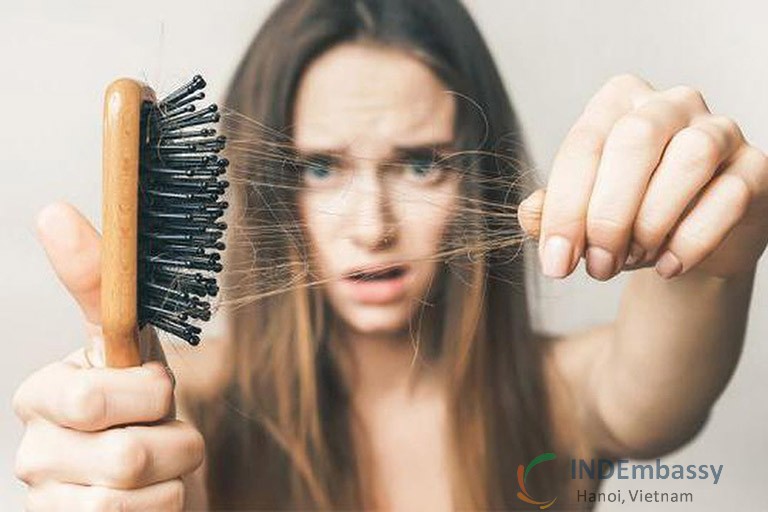 Thận yếu có gây rụng tóc không?